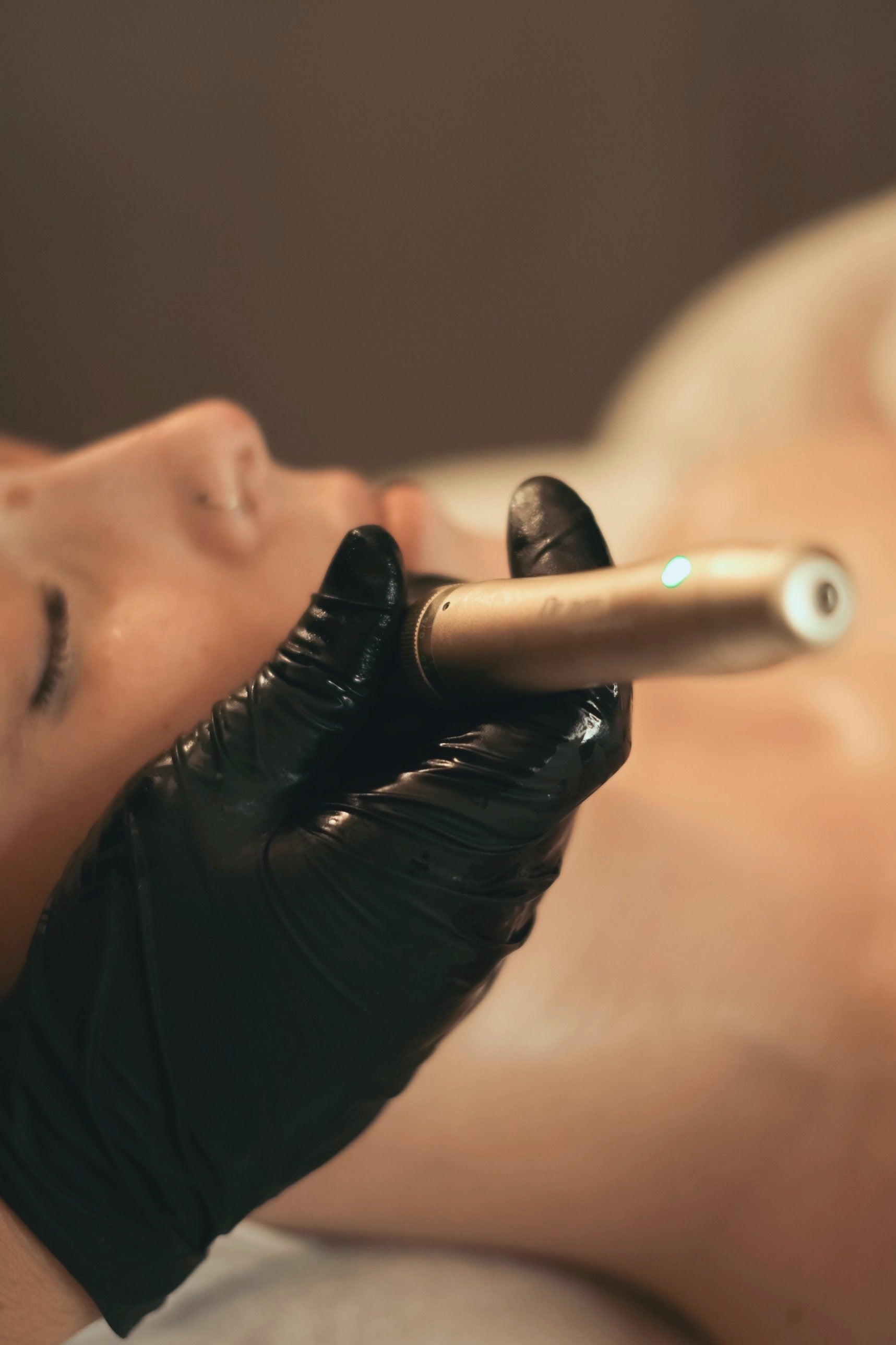 A gloved therapist holding a microneedling pen to a relaxed client